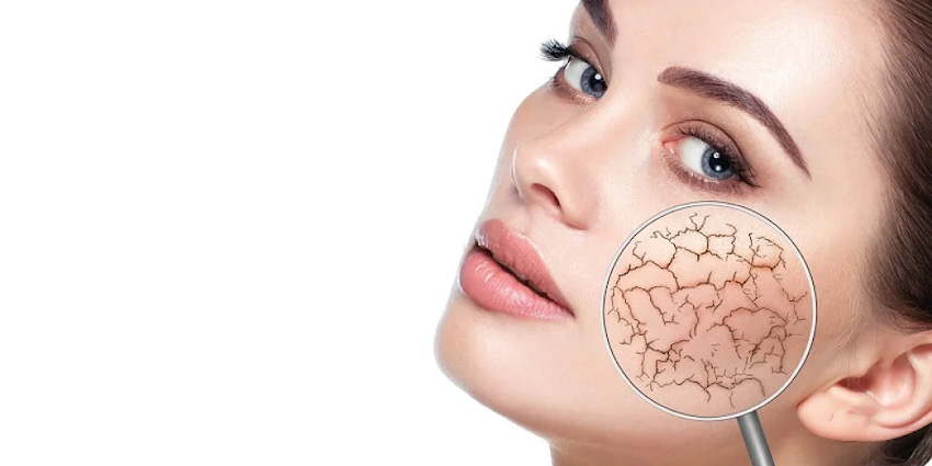 فرق پوست خشک و پوست دهیدراته چیست؟